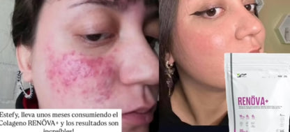 💜 Colágeno Renova+ Premium